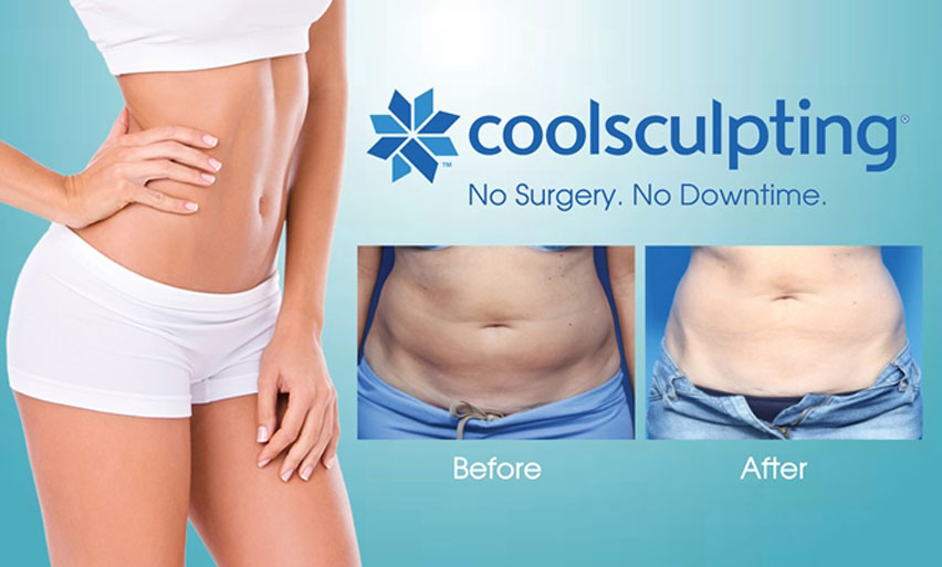 Cool Sculpting in Jacksonville FL